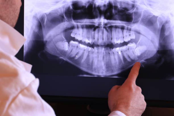 Best Emergency Tooth Extraction in Watsontown, PA