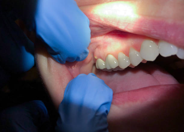 Best Walk-In Emergency Dentist in Watsontown, PA