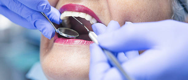 Best Emergency Root Canal Treatment in Watsontown, PA