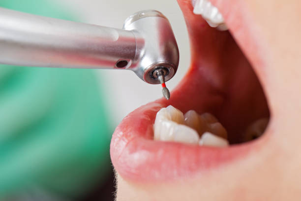 Best Emergency Broken Tooth Repair in Watsontown, PA